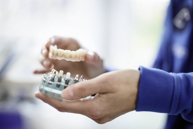 Zahnersatz aus Keramik bei Ihrem Zahnarzt Lindeman in Zeven